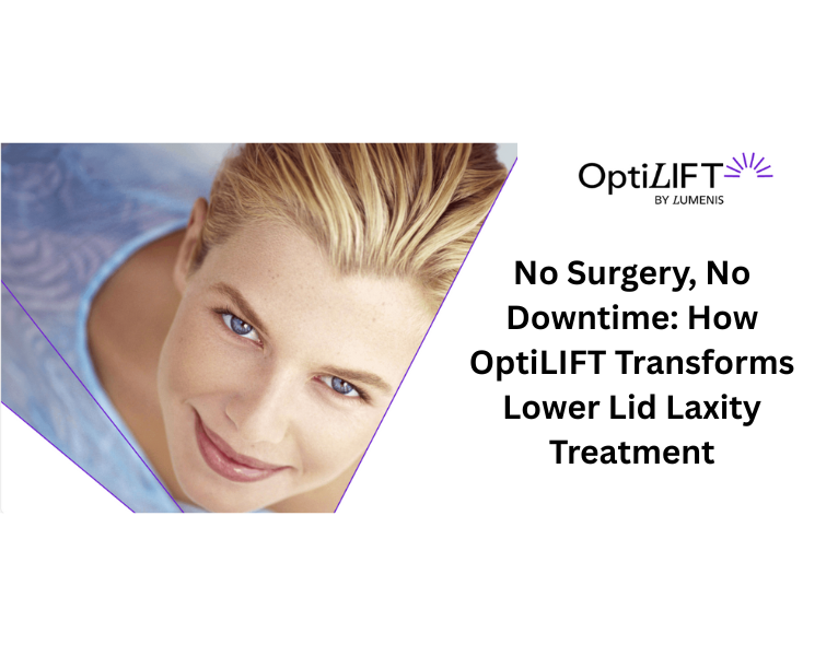 No Surgery, No Downtime How OptiLIFT Transforms Lower Lid Laxity Treatment